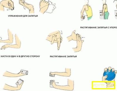 Упражнения след счупване на ръката: възстановяване на