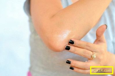 Причини за лющене на кожата по лактите, етапи и форми на